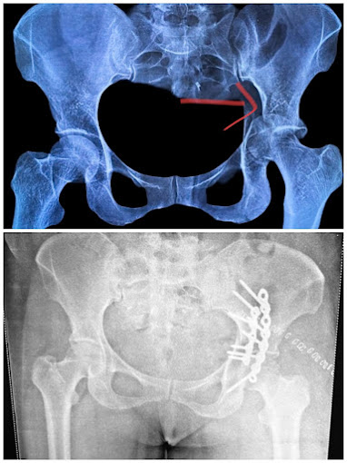 orthopedic-doctor-dehradun-27.jpg